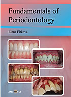 Fundamentals of Periodоntology