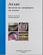 Атлас болести на лигавицата на устата