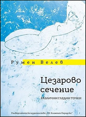 Цезарово сечение. Различни гледни точки