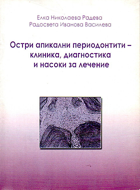 ОСТРИ АПИКАЛНИ ПЕРИОДОНТИТИТИ - клиника, диагностика и насока за лечение
